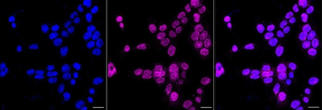 MHC Class I Antibody in Immunocytochemistry (ICC/IF)