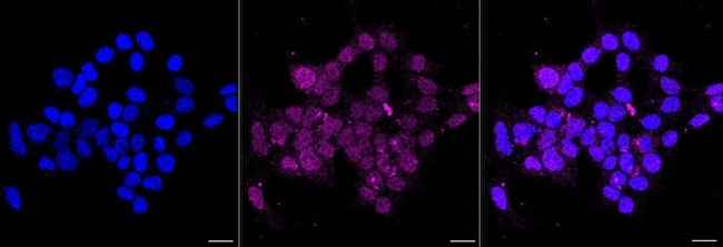 LAP3 Antibody in Immunocytochemistry (ICC/IF)