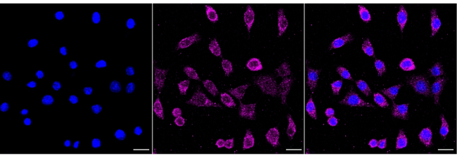 Cytokeratin 13 Antibody in Immunocytochemistry (ICC/IF)