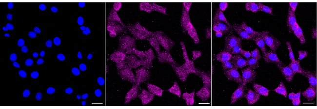IRF6 Antibody in Immunocytochemistry (ICC/IF)