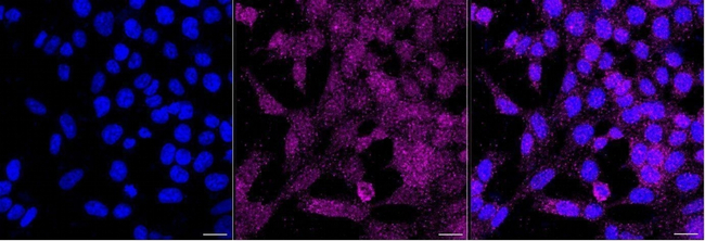 HOMER1 Antibody in Immunocytochemistry (ICC/IF)