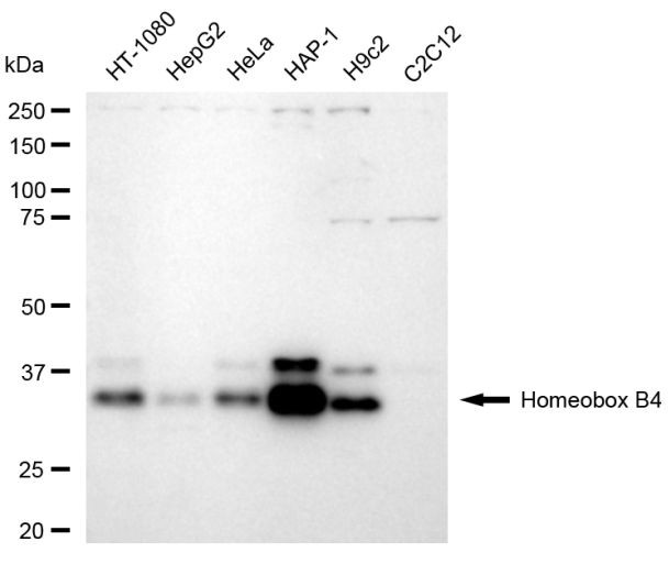 HOXB4 Antibody in Western Blot (WB)