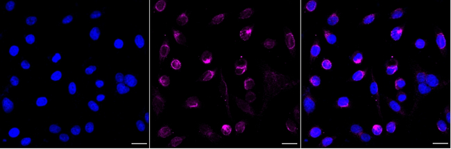 HOXA9 Antibody in Immunocytochemistry (ICC/IF)