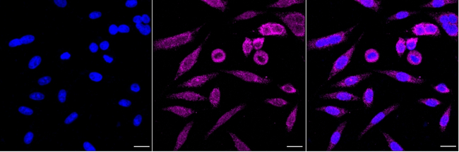 Lefty1/Lefty2 Antibody in Immunocytochemistry (ICC/IF)