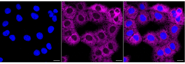 IMPDH2 Antibody in Immunocytochemistry (ICC/IF)