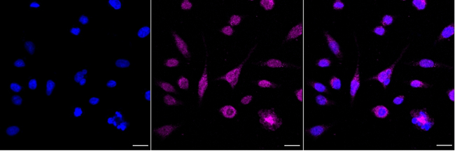 LHX2 Antibody in Immunocytochemistry (ICC/IF)