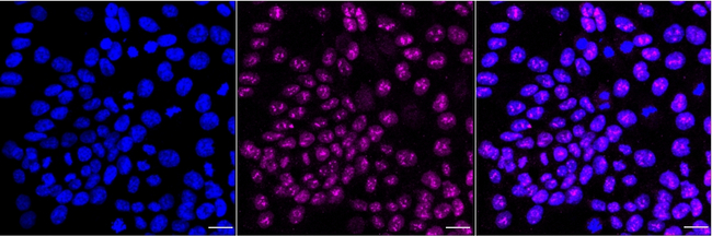 OTX1 Antibody in Immunocytochemistry (ICC/IF)