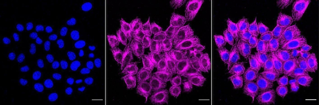 ENPP5 Antibody in Immunocytochemistry (ICC/IF)