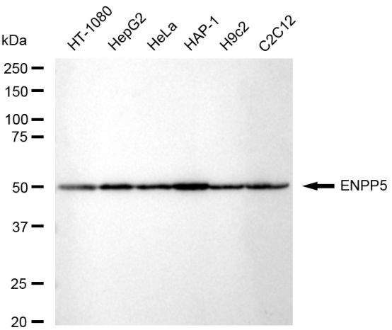 ENPP5 Antibody in Western Blot (WB)