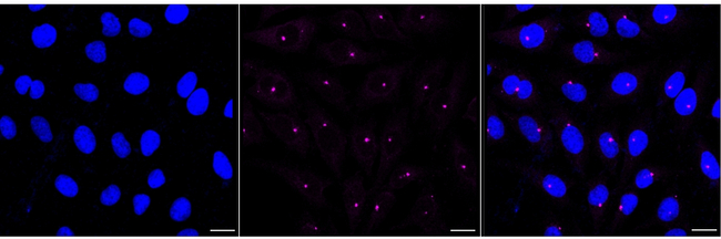 FGFR1OP Antibody in Immunocytochemistry (ICC/IF)