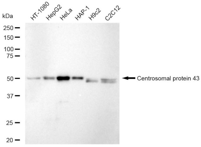 FGFR1OP Antibody in Western Blot (WB)