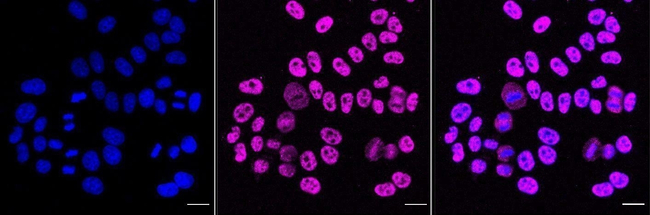 GPRC5B Antibody in Immunocytochemistry (ICC/IF)
