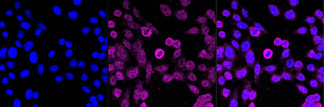 DKC1 Antibody in Immunocytochemistry (ICC/IF)