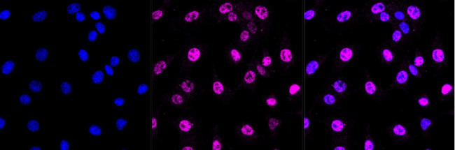 DLX3 Antibody in Immunocytochemistry (ICC/IF)