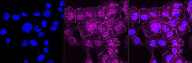 Epsin 1 Antibody in Immunocytochemistry (ICC/IF)