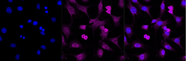 CRMP3 Antibody in Immunocytochemistry (ICC/IF)