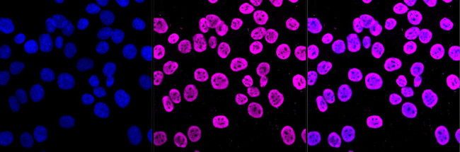 EWSR1 Antibody in Immunocytochemistry (ICC/IF)
