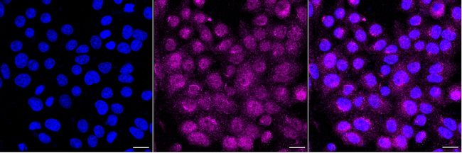 GLI3 Antibody in Immunocytochemistry (ICC/IF)