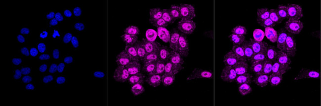 BCL11B Antibody in Immunocytochemistry (ICC/IF)