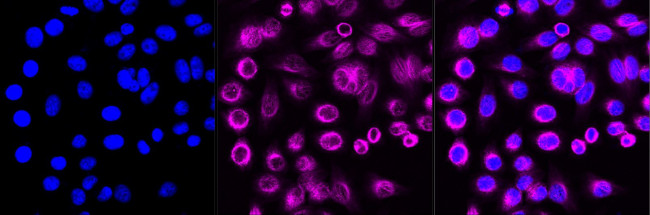 CBX4 Antibody in Immunocytochemistry (ICC/IF)