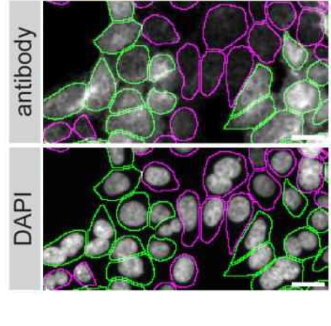 CDK5 Antibody in Immunocytochemistry (ICC/IF)