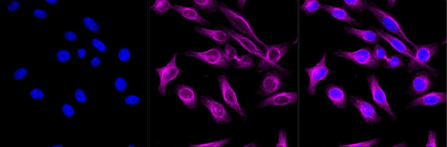 alpha-1a Adrenergic Receptor Antibody in Immunocytochemistry (ICC/IF)