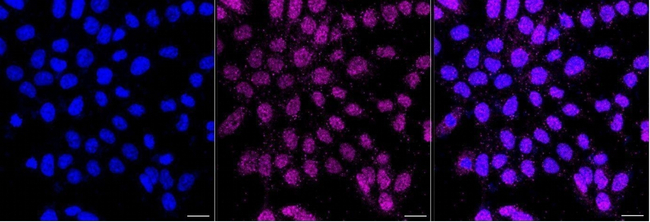 Asparagine Synthetase Antibody in Immunocytochemistry (ICC/IF)