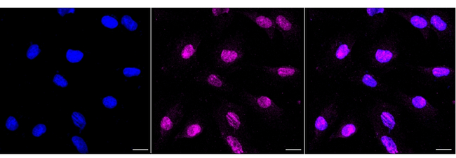 Cyclophilin B Antibody in Immunocytochemistry (ICC/IF)