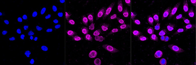 HSPB8 Antibody in Immunocytochemistry (ICC/IF)