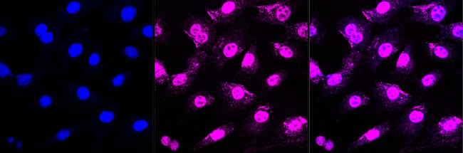 MCM6 Antibody in Immunocytochemistry (ICC/IF)