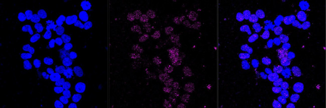 IQGAP2 Antibody in Immunocytochemistry (ICC/IF)