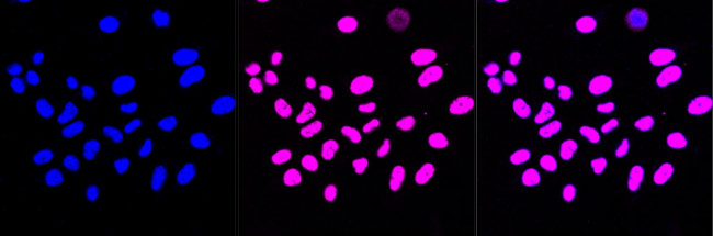 HDAC9 Antibody in Immunocytochemistry (ICC/IF)