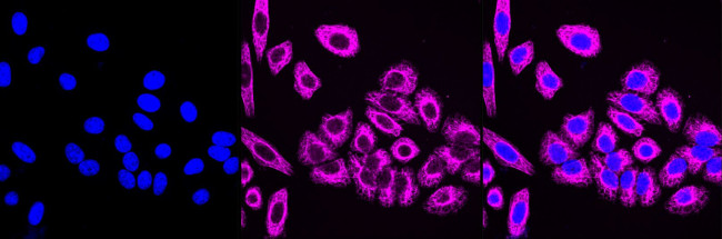 NEK2 Antibody in Immunocytochemistry (ICC/IF)