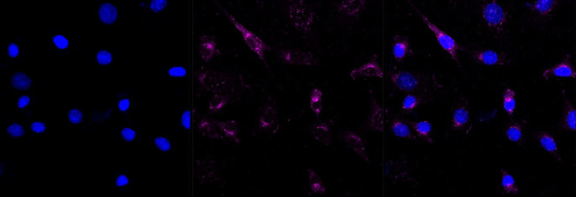 TAX1BP1 Antibody in Immunocytochemistry (ICC/IF)