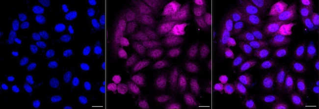 IDH1 Antibody in Immunocytochemistry (ICC/IF)