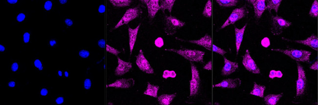 PCBP2 Antibody in Immunocytochemistry (ICC/IF)