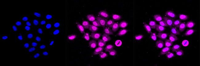 PRDX1 Antibody in Immunocytochemistry (ICC/IF)