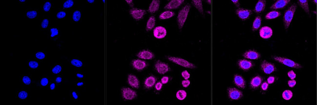 NDUFS3 Antibody in Immunocytochemistry (ICC/IF)