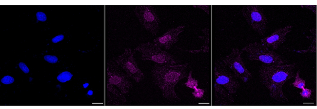 PSMB10 Antibody in Immunocytochemistry (ICC/IF)