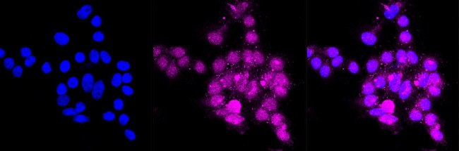 Syntenin 1 Antibody in Immunocytochemistry (ICC/IF)