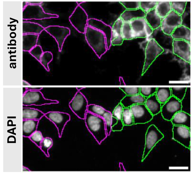 Syntenin 1 Antibody in Immunocytochemistry (ICC/IF)
