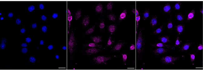JNK1 Antibody in Immunocytochemistry (ICC/IF)