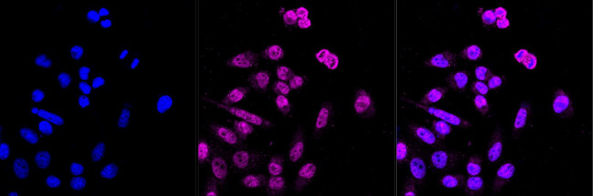 USP7 Antibody in Immunocytochemistry (ICC/IF)