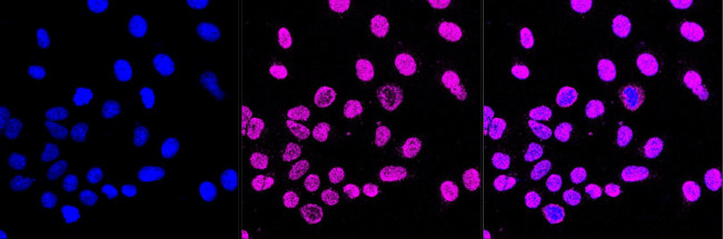 DDB1 Antibody in Immunocytochemistry (ICC/IF)