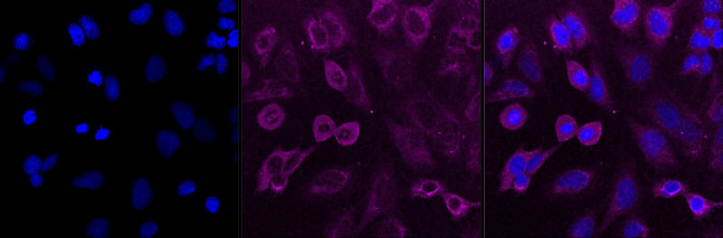 Calcineurin A Antibody in Immunocytochemistry (ICC/IF)