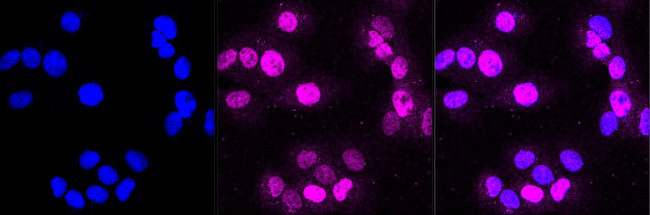 DDB2 Antibody in Immunocytochemistry (ICC/IF)
