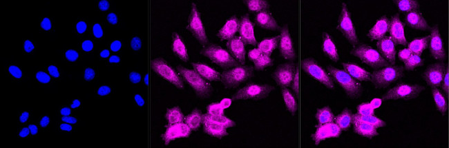 CHMP2B Antibody in Immunocytochemistry (ICC/IF)