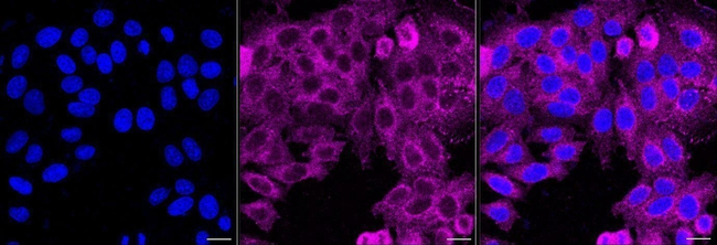 CC2D1A Antibody in Immunocytochemistry (ICC/IF)