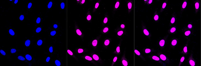 CIRBP Antibody in Immunocytochemistry (ICC/IF)