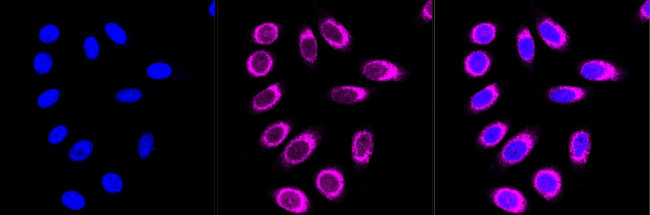 CoA Synthase Antibody in Immunocytochemistry (ICC/IF)